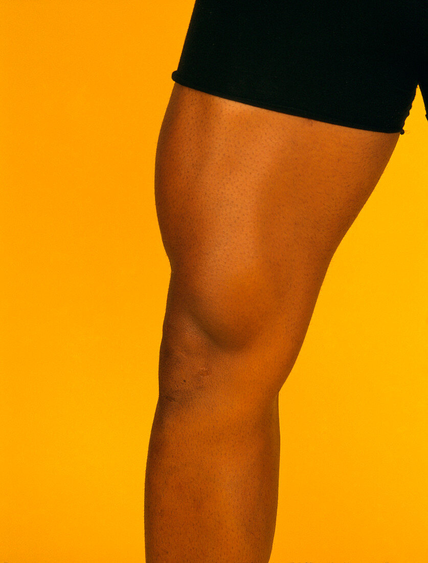 View of the well-muscled thigh of male bodybuilder