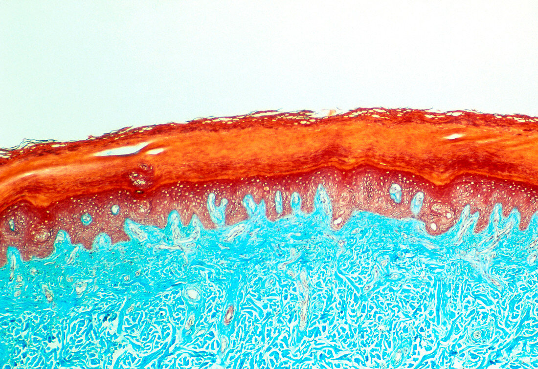LM of a section through human skin