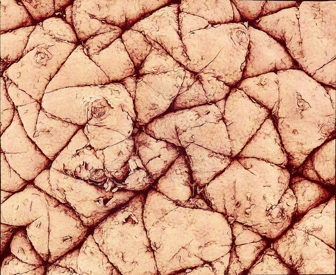 Human skin surface,SEM