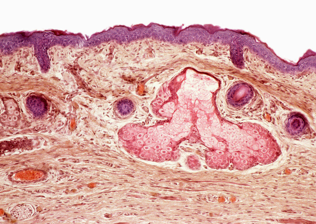 Skin layers,light micrograph