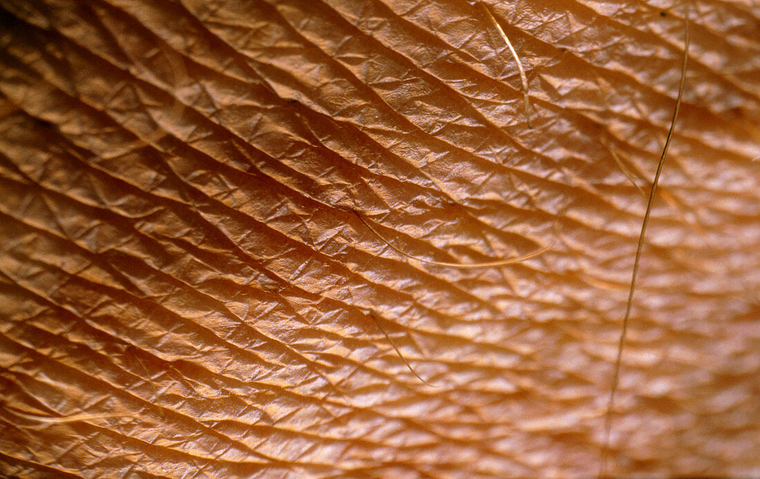 Macrophoto of the skin of the back of the hand