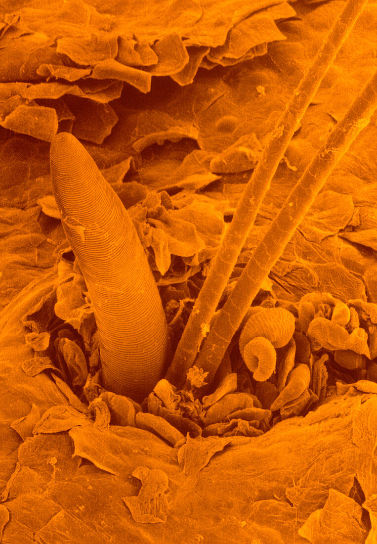 False-col SEM of surface of human scalp