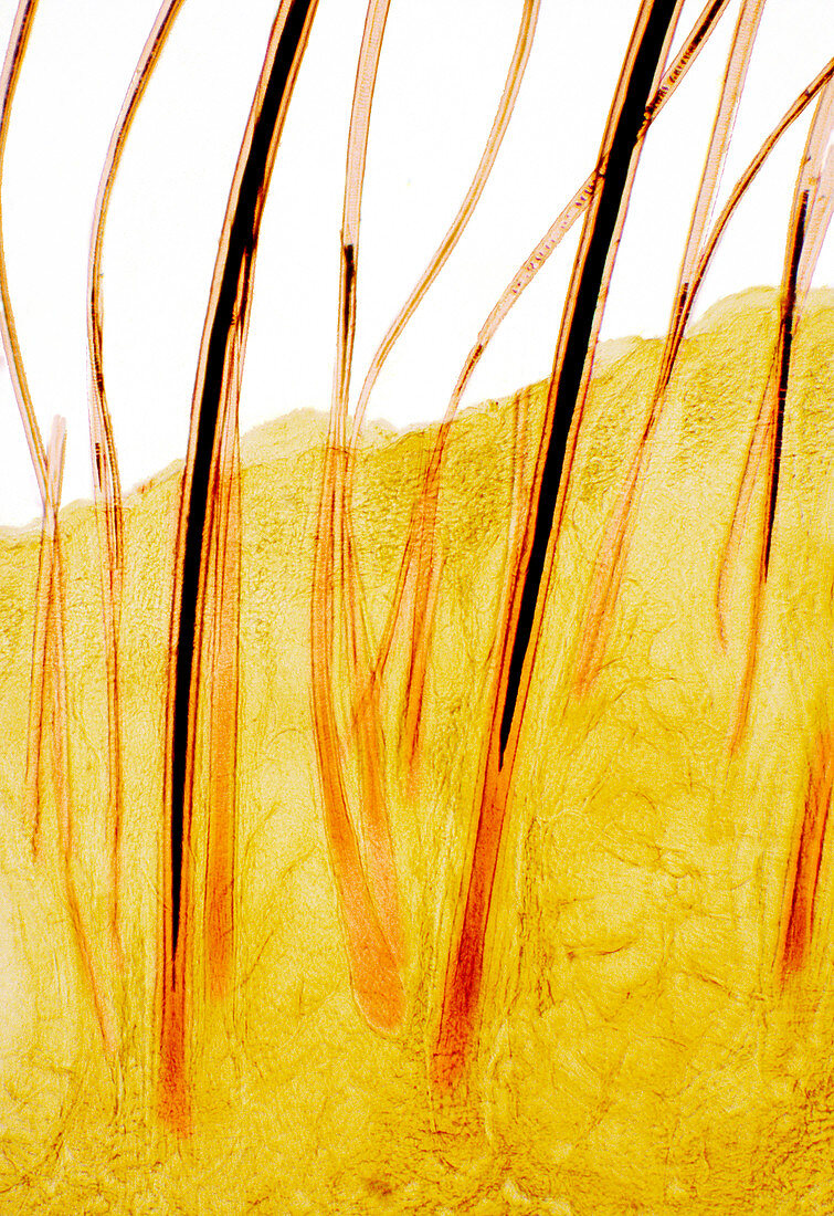 Hairs on the scalp,light micrograph