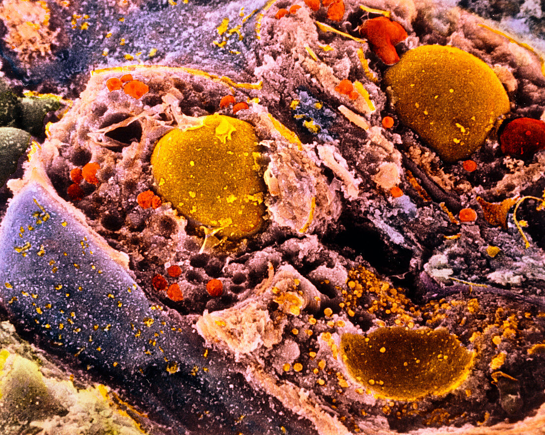 Coloured SEM of secretory cells in adrenal gland