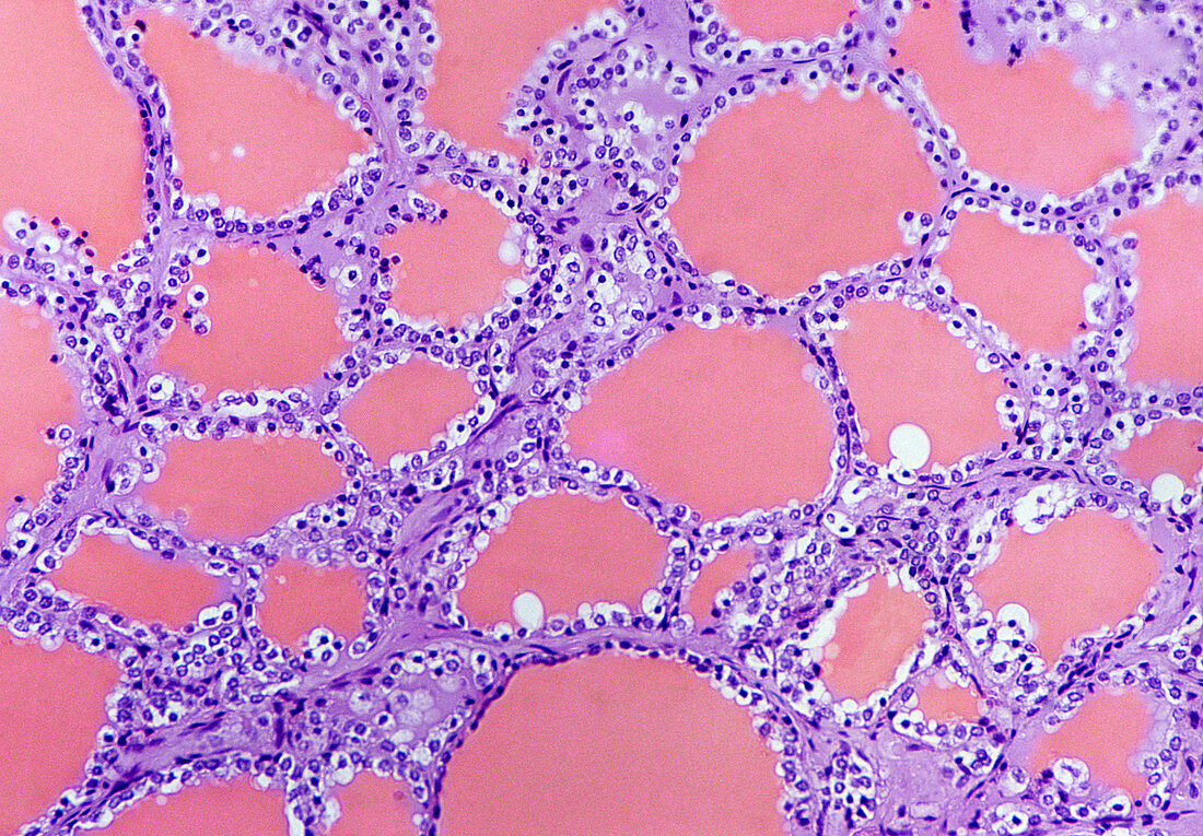 Thyroid gland,light micrograph