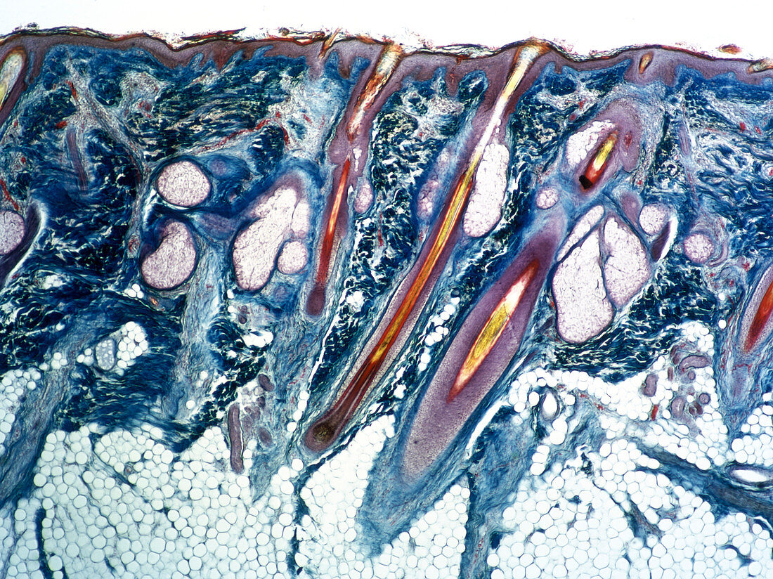 LM of section of human skin showing hair follicles