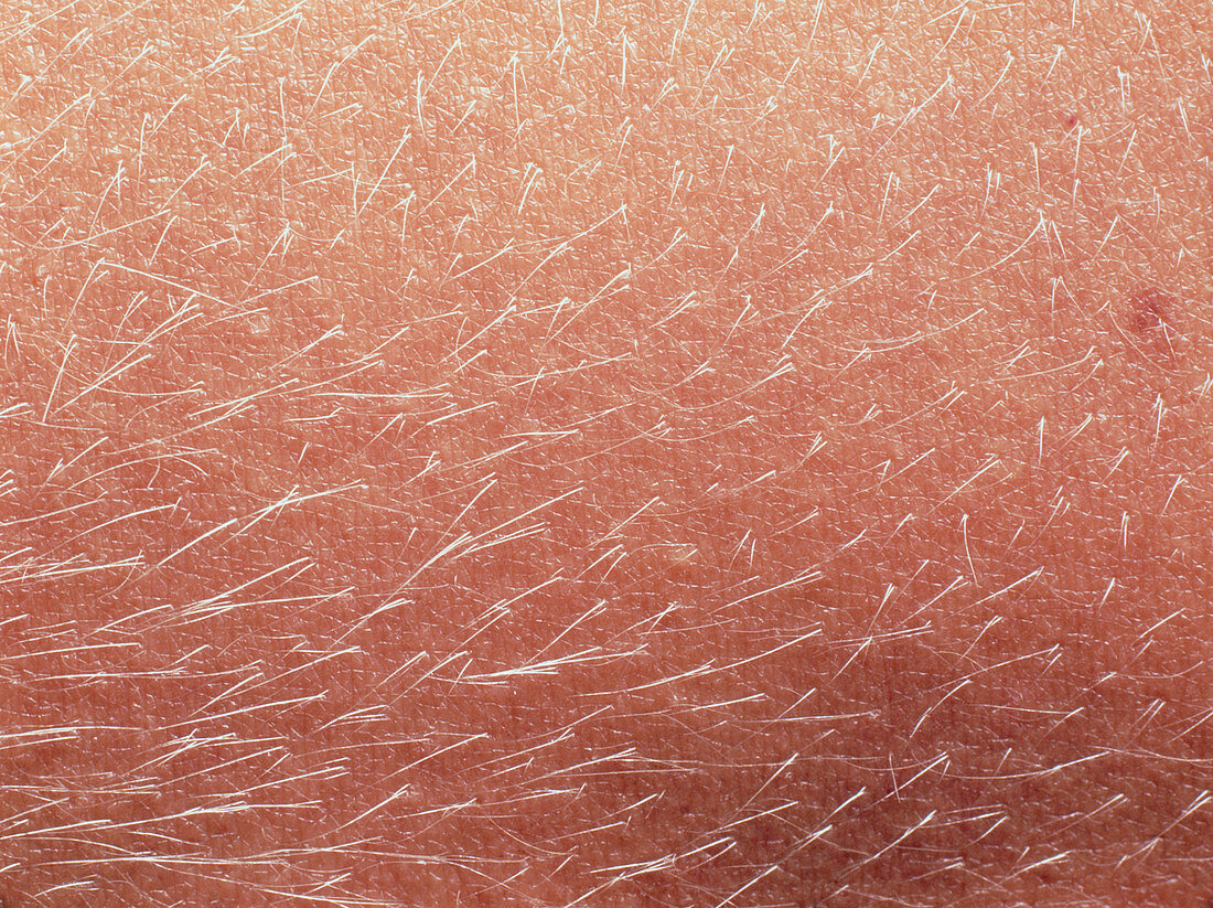 Close-up of hairs on the skin of a woman