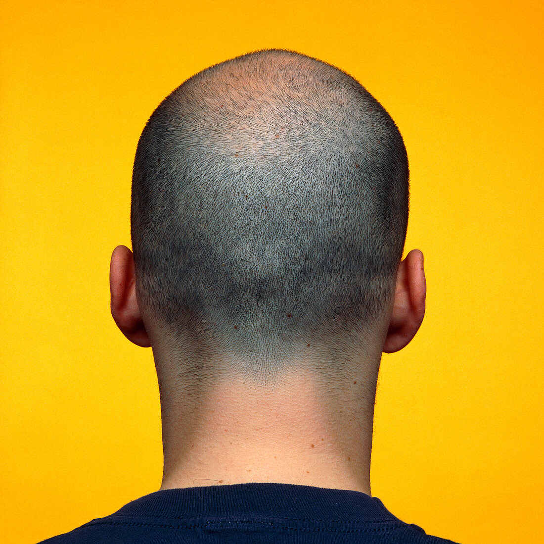 Rear view of a male head with very short hair