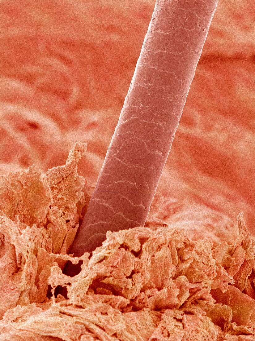 Human hair,SEM