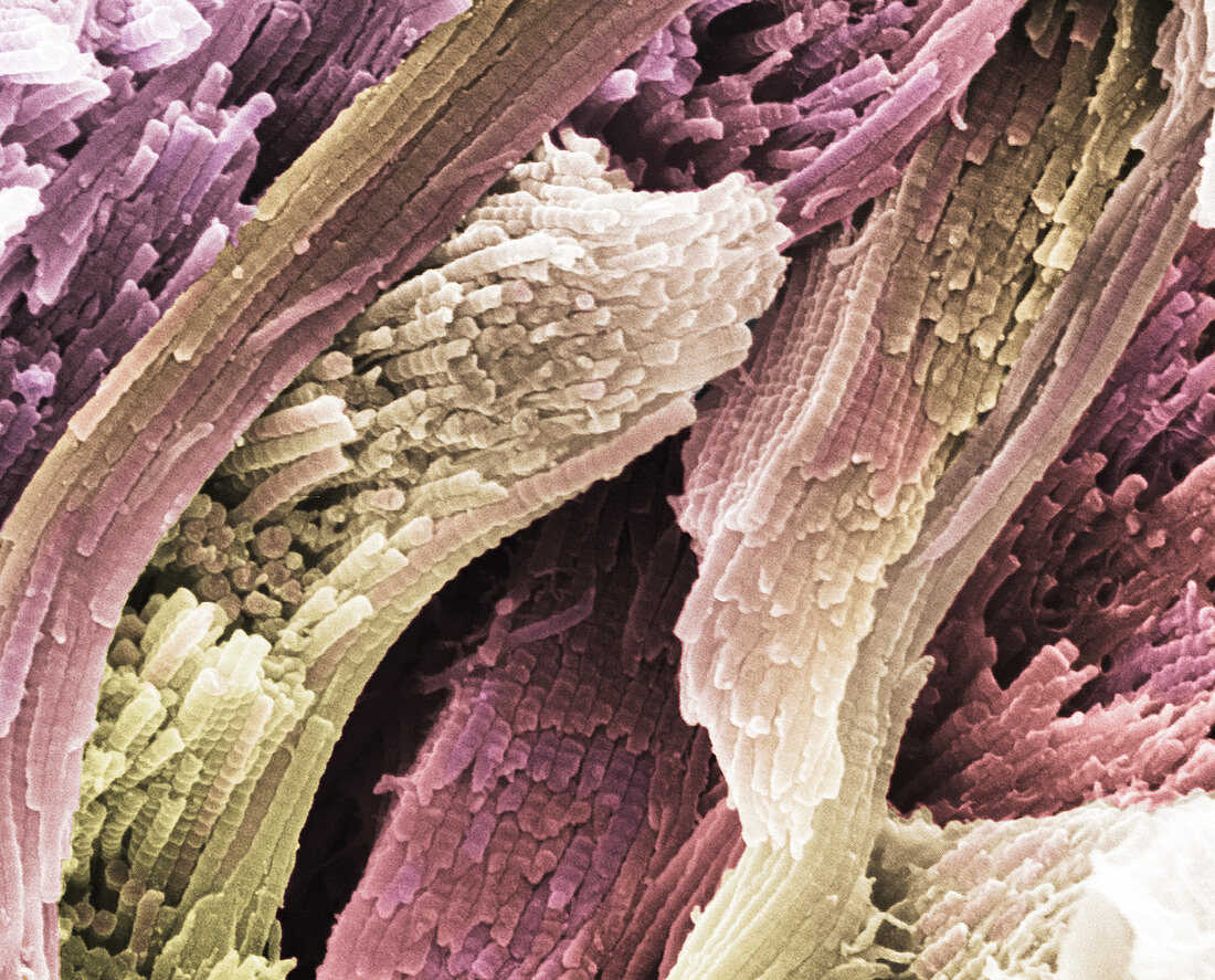 Collagen fibres,SEM