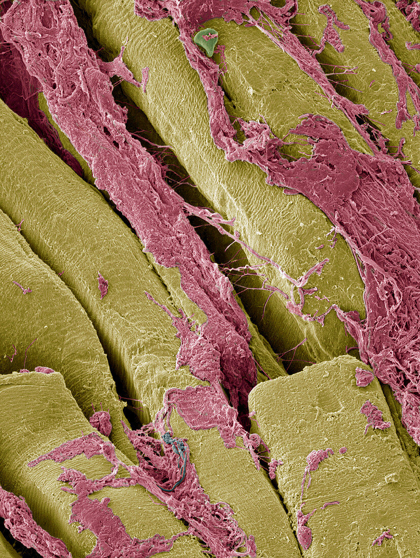 Periodontal ligament fibres,SEM