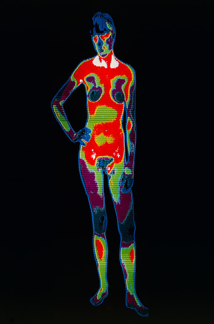 Thermogram of a woman