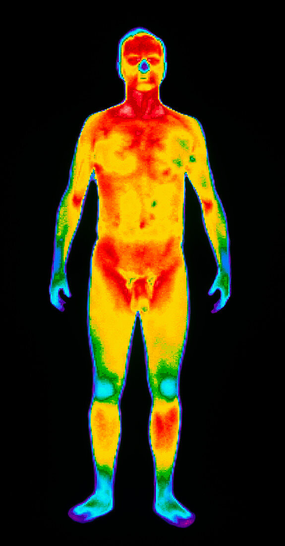 Thermogram of a standing naked man (front view)
