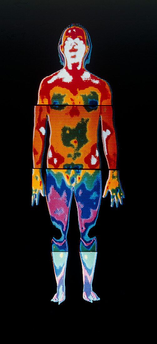 Thermogram of a man