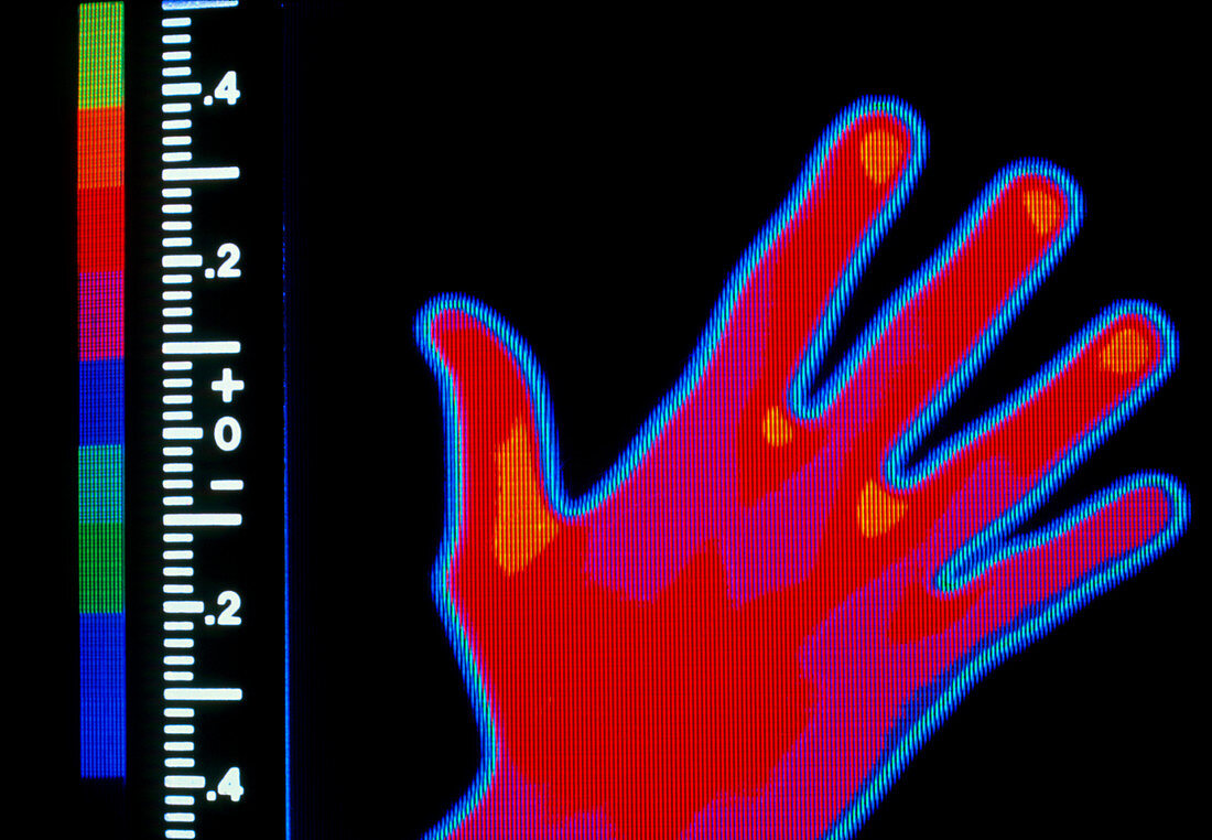 Thermogram of a human hand
