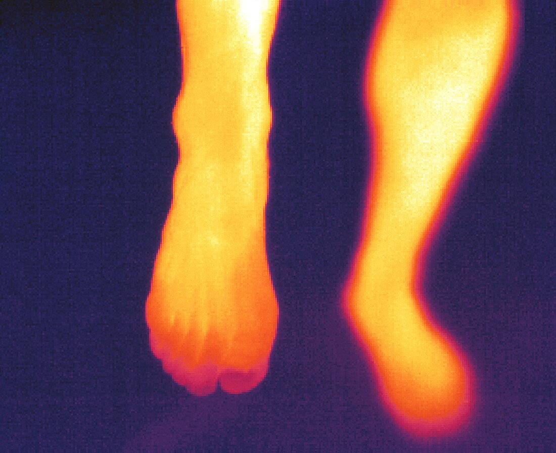 Thermogram of feet