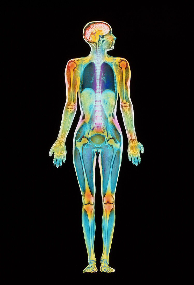 Coloured MRI scan of a whole human body (female)