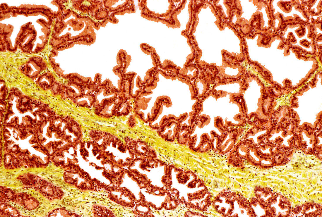 Prostate gland,light micrograph