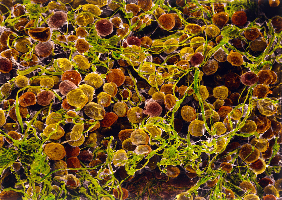 Coloured SEM of adipose tissue showing fa