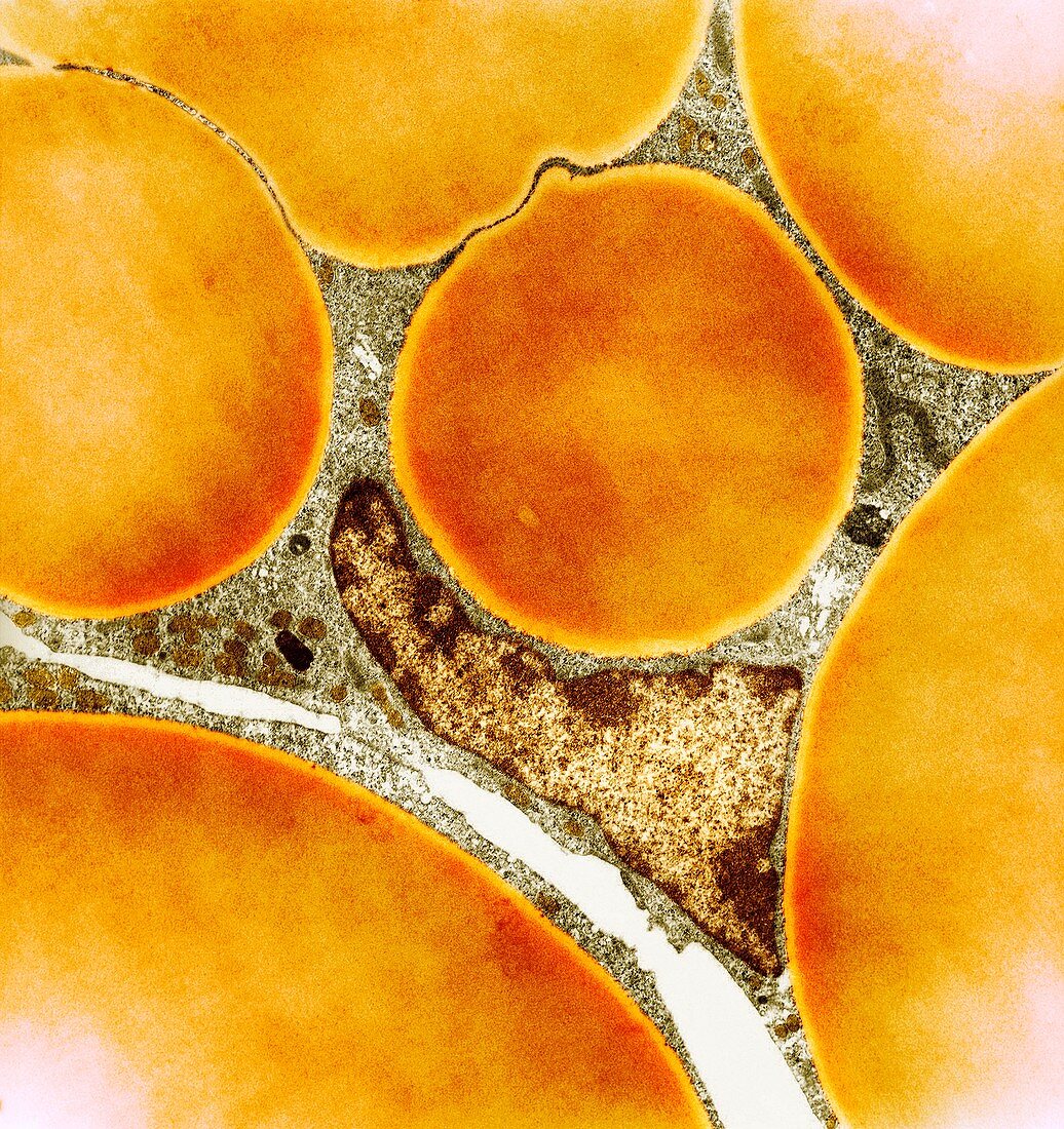 Fat cells,TEM