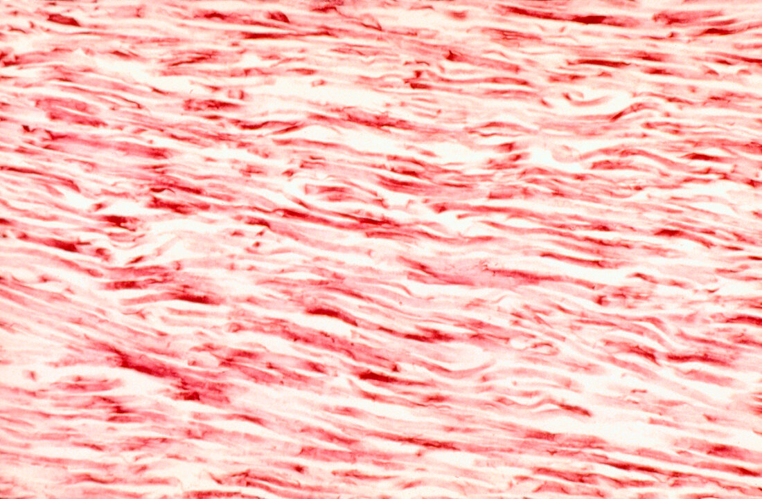 Ordinary connective tissue with elastin