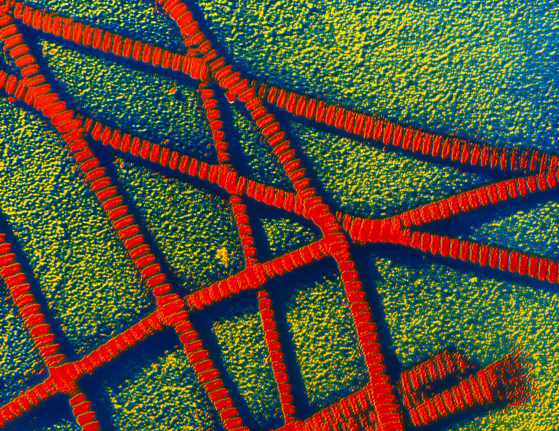 False-colour TEM of collagen fibrils