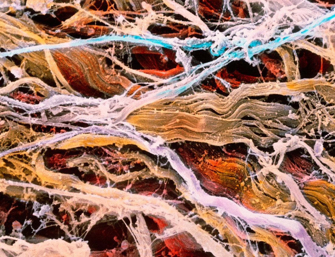 False-colour SEM of bundles of connective tissue