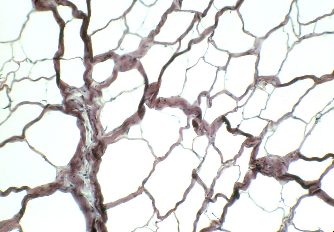 Light micrograph of a network of connective tissue