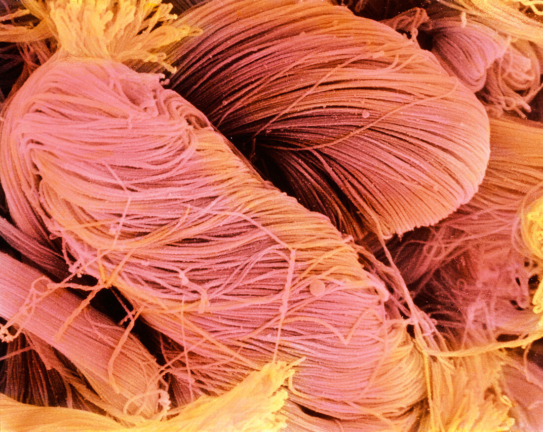 Colour SEM of collagen fibrils in urinary bladder