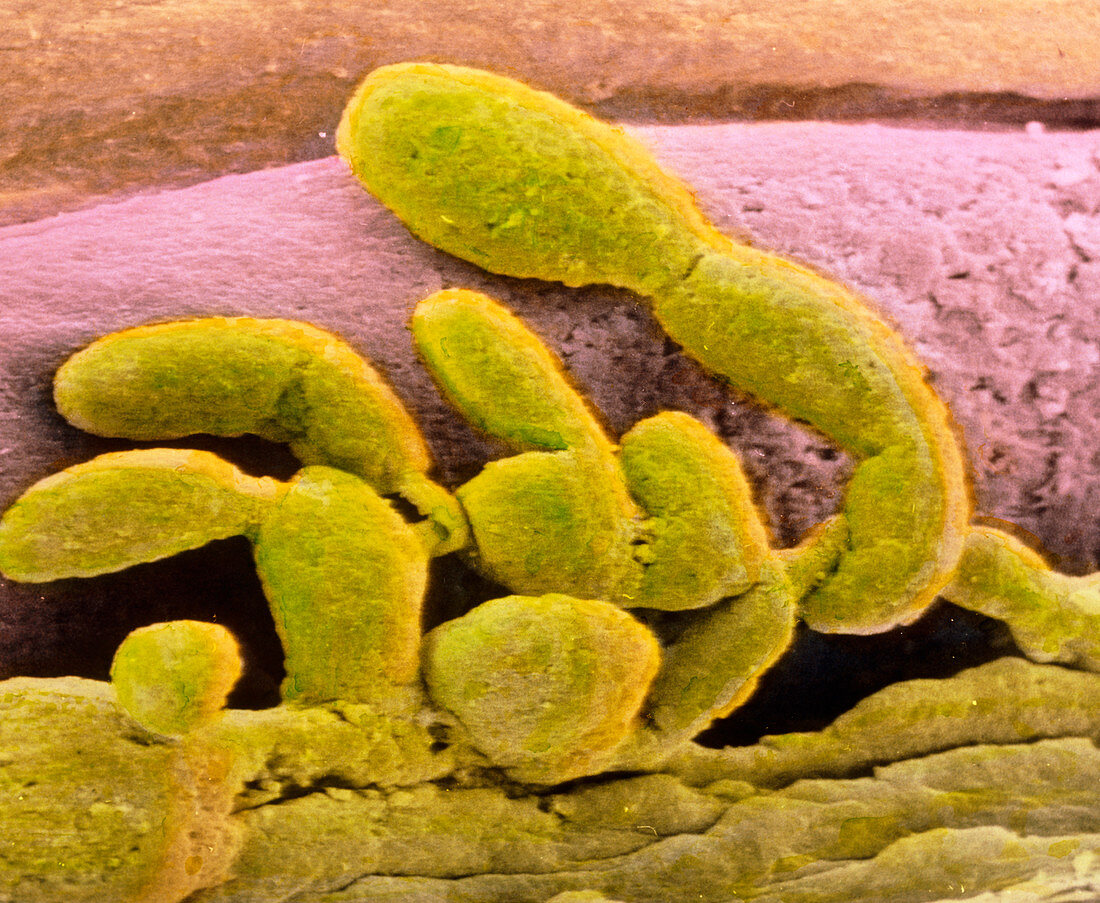Coloured SEM of the synovial membrane of a joint