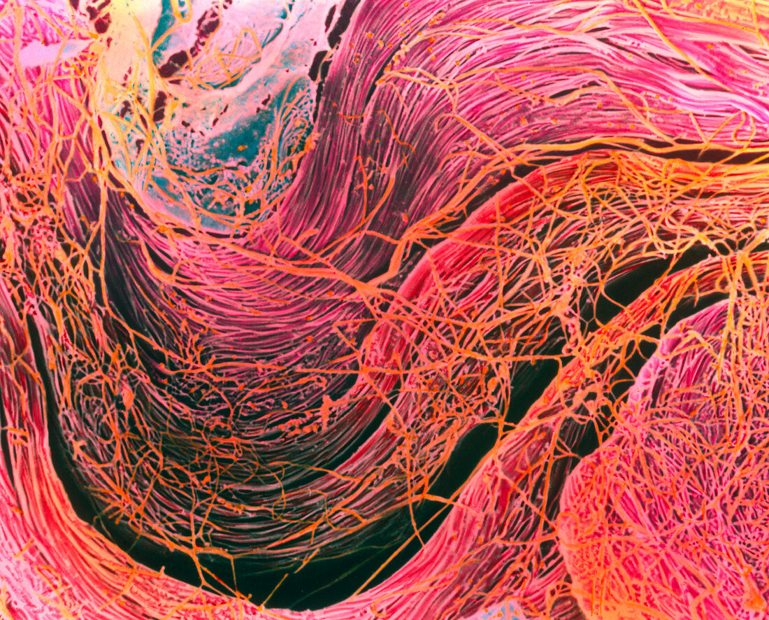 Coloured SEM of collagen connective tissue fibres