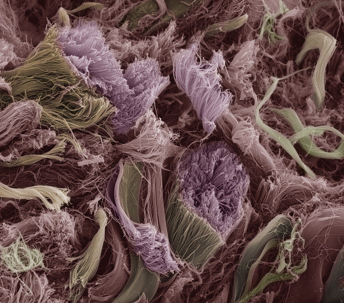 Collagen fibres,SEM