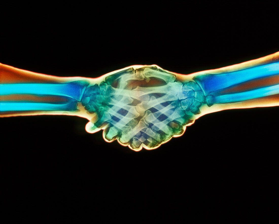 Coloured X-ray of a handshake