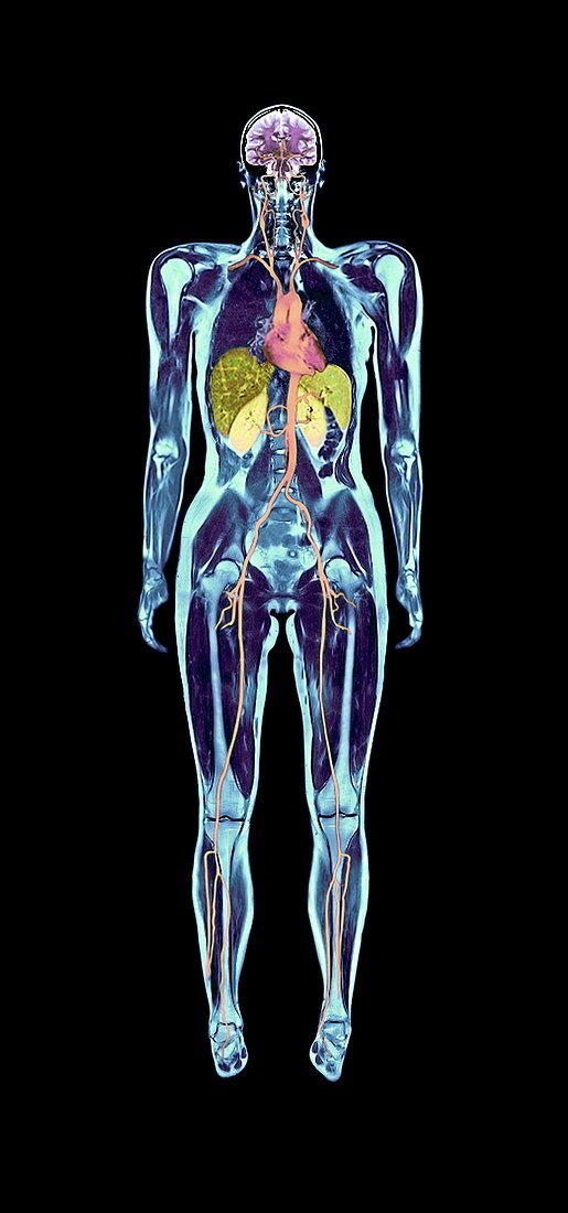 Full body scan,MRI scan