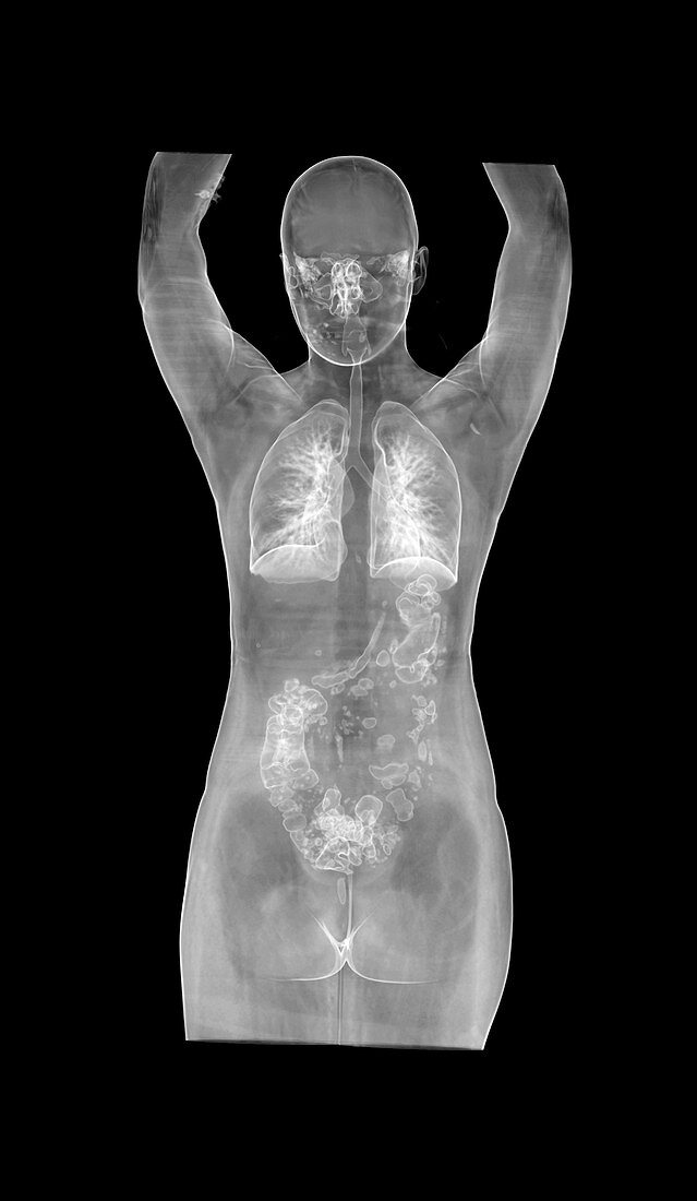 Female body,CT scan