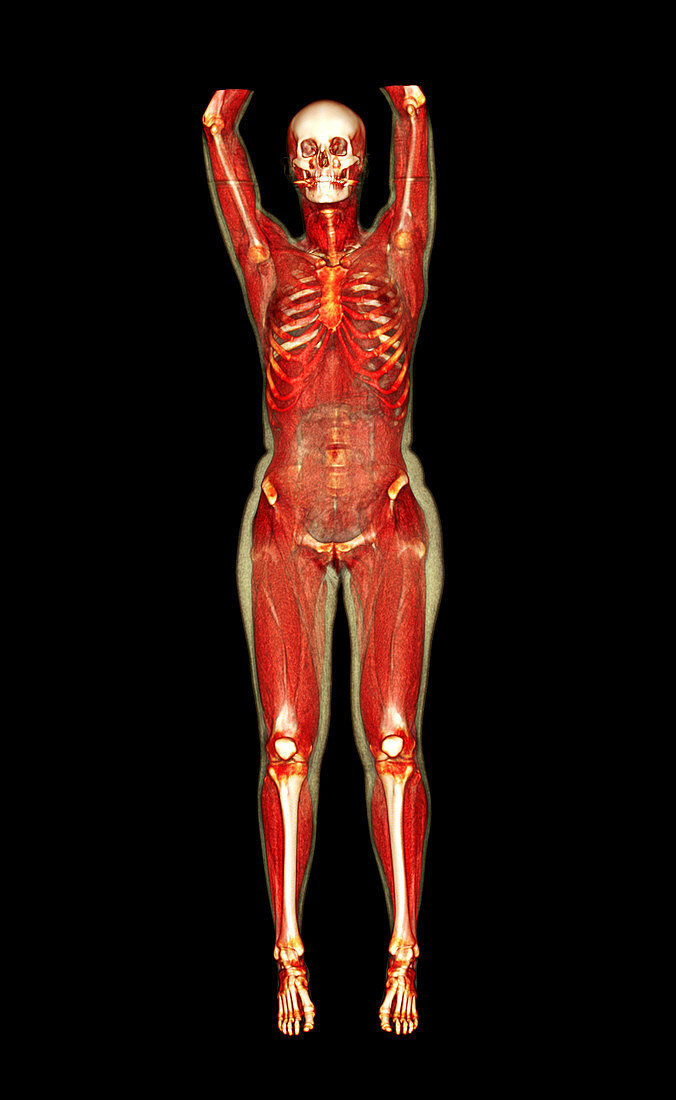 Female body,CT scan