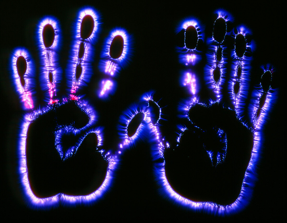 Kirlian photograph of human hands