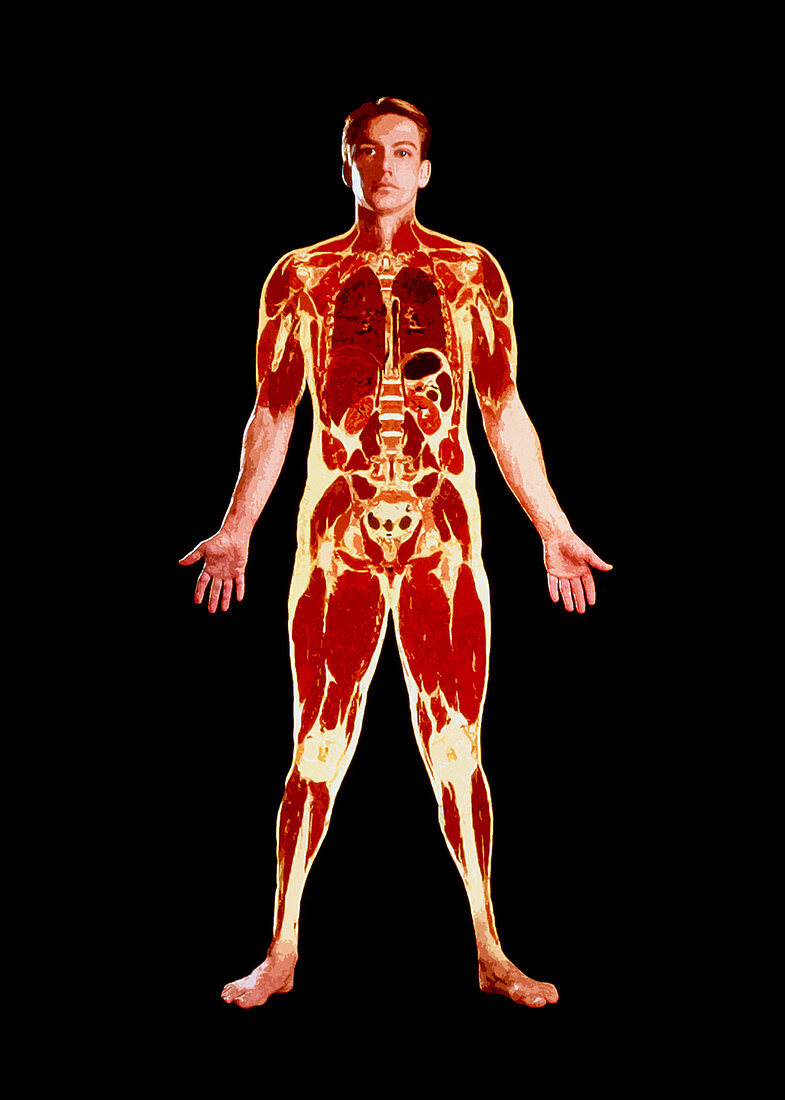 Visible Human Project: sectioned male body (front)