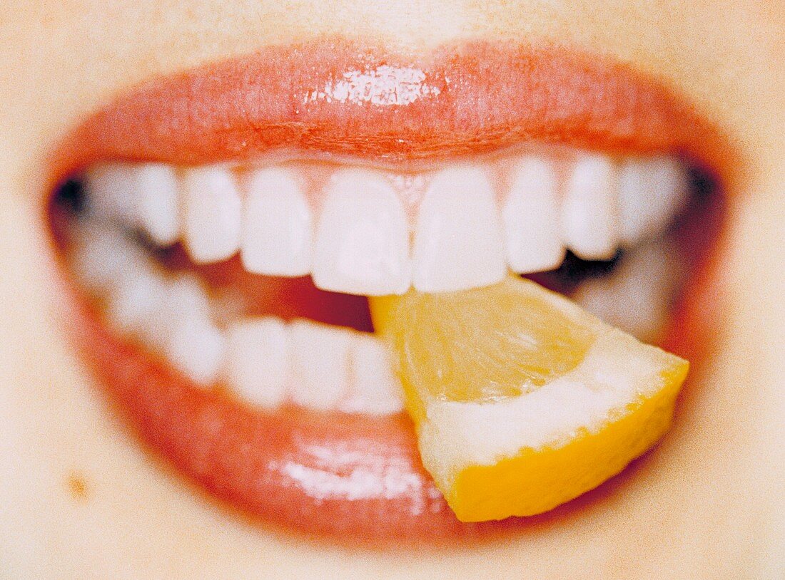 Slice of lemon between teeth