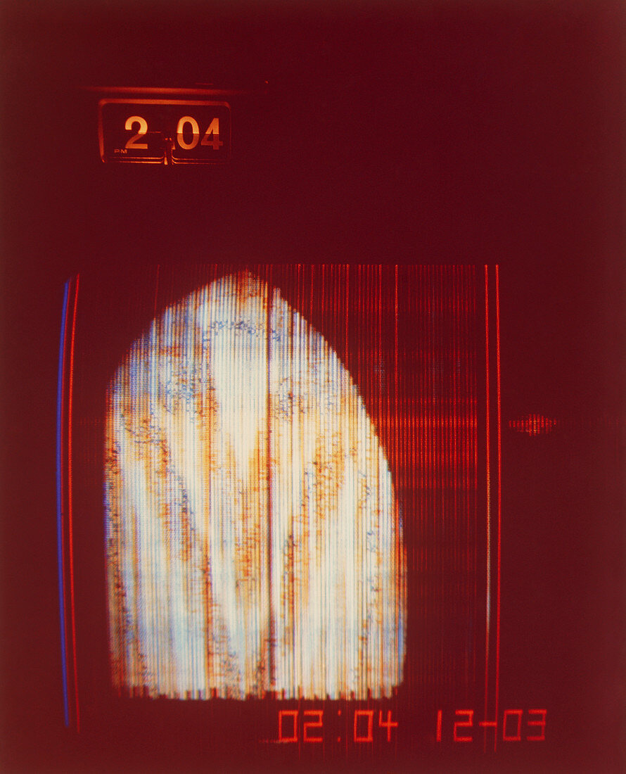 Pioneer 10 TV scan of part of Jupiter