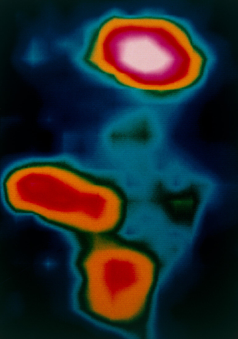 Infrared image of the BNKL star formation region