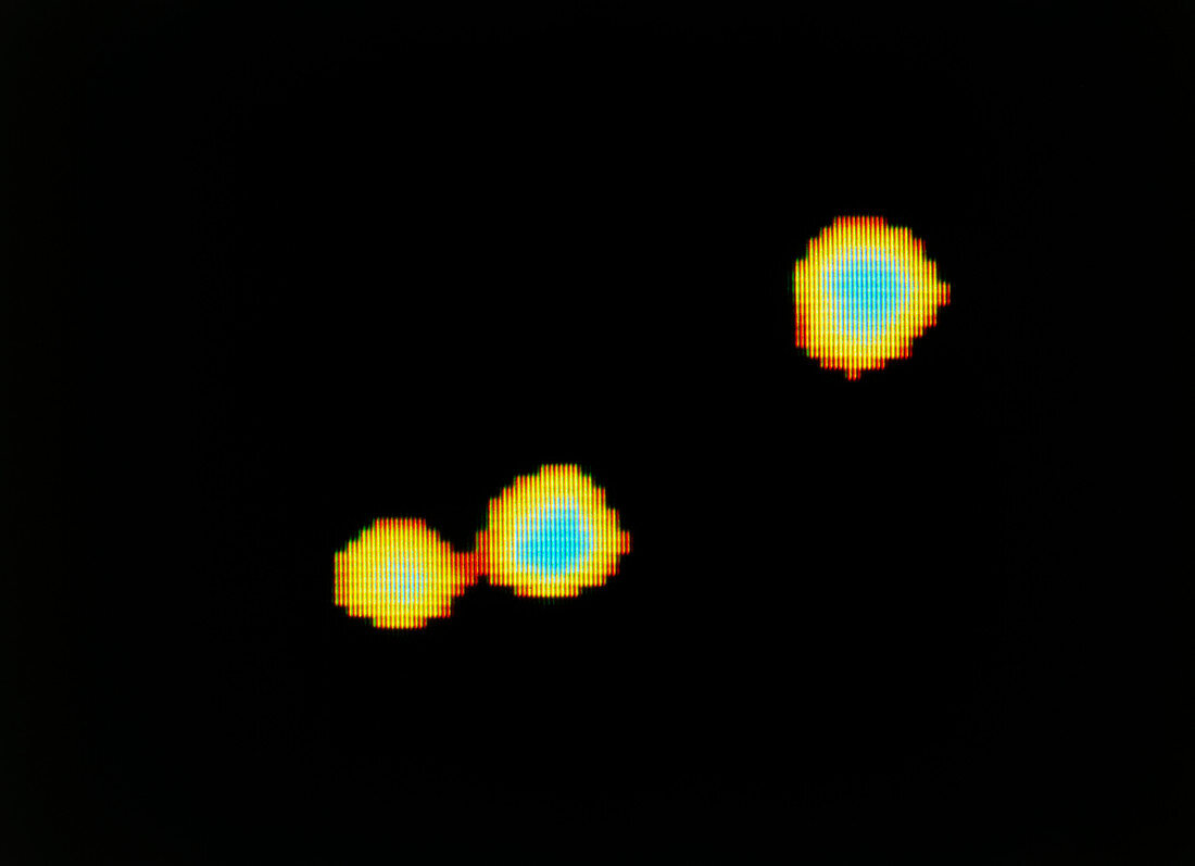 Beta Monocerotis,a triple star