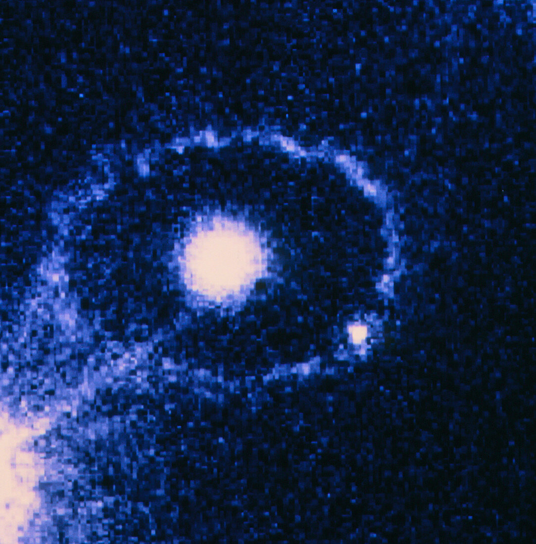 UV image of supernova SN 1987A