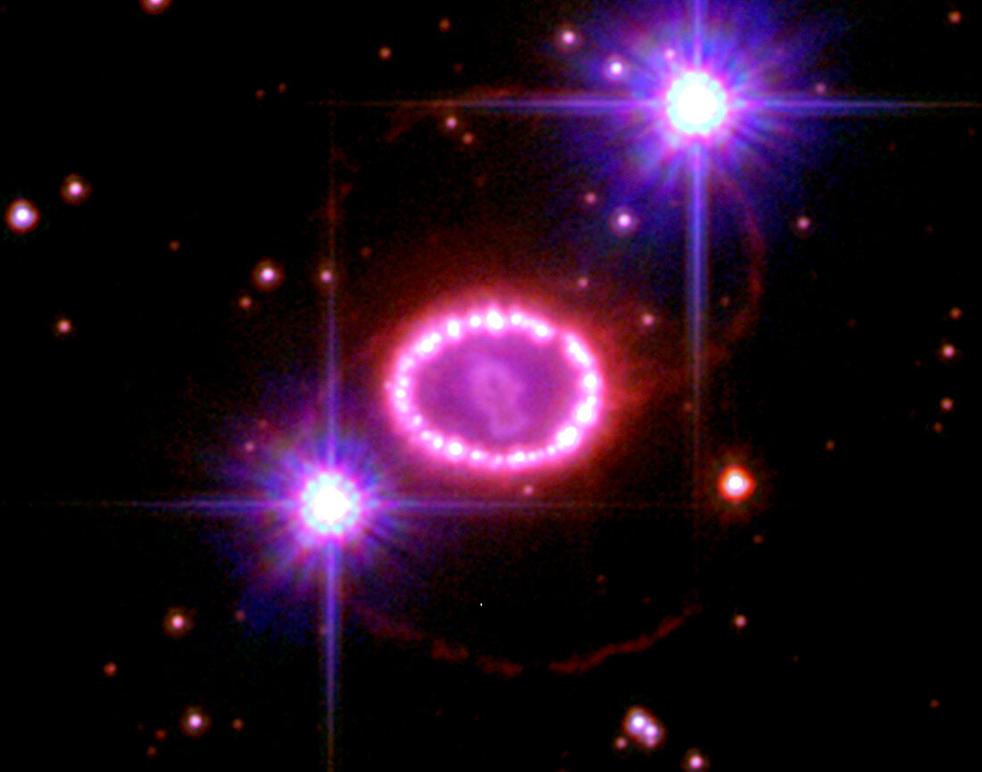 Supernova 1987a remnant,HST image