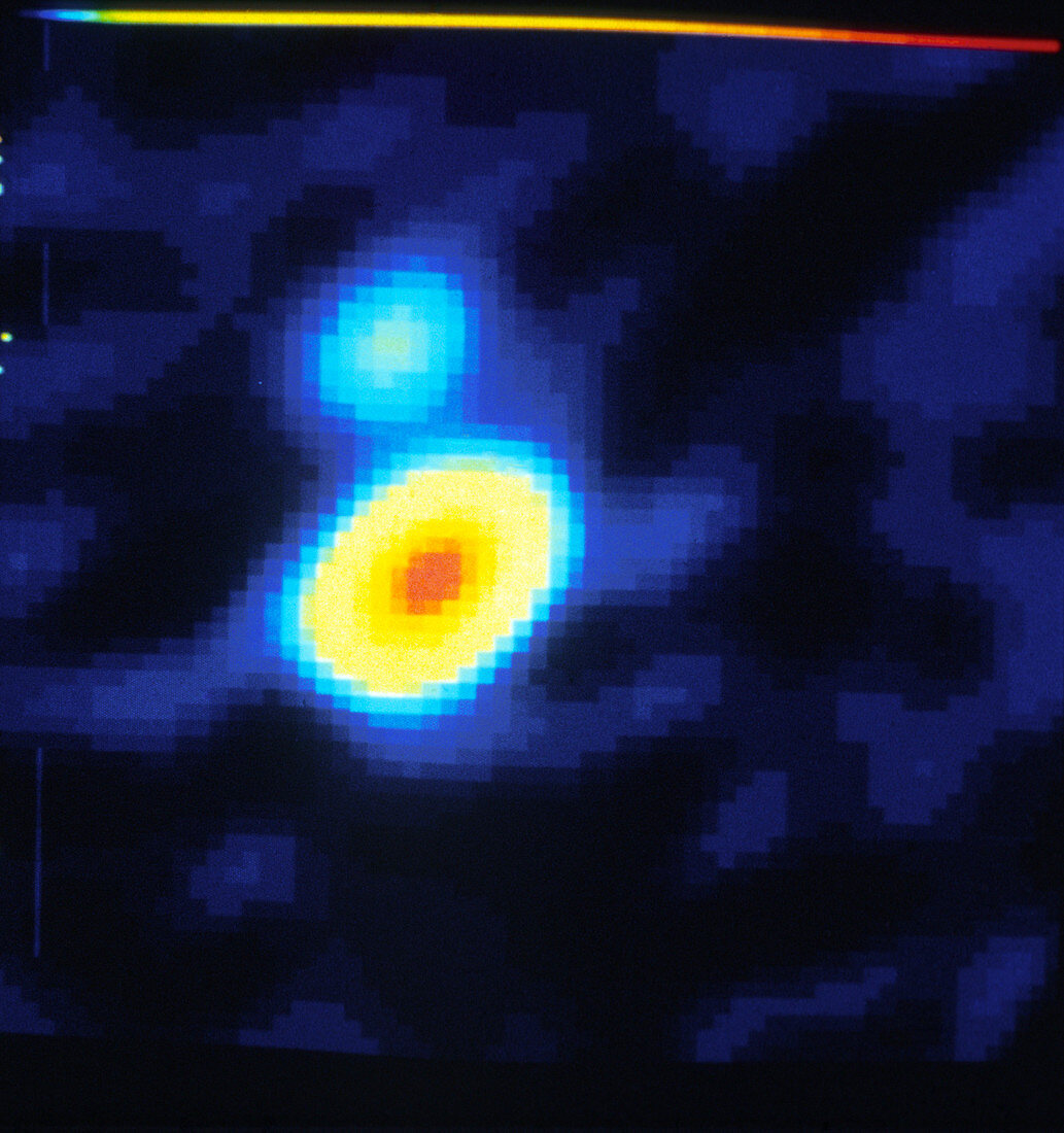 Radio map of the double quasar 0957+561