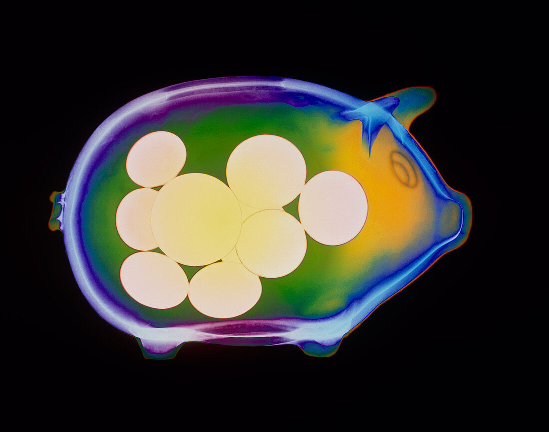Coloured X-ray of a piggybank containing coins