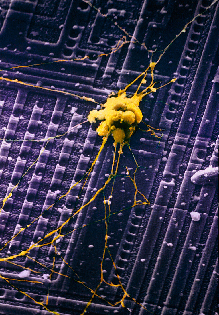 SEM of human nerve cells on silicon chip