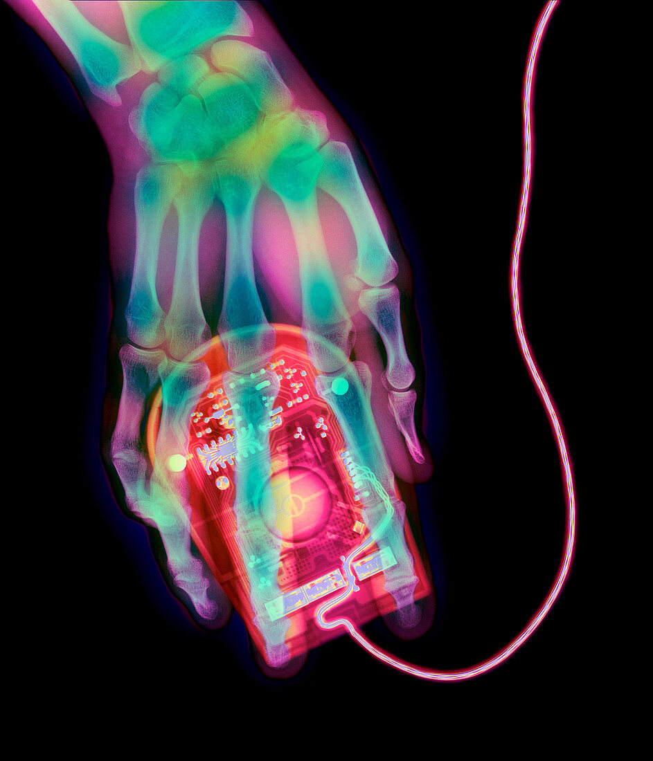 Coloured X-ray of a computer mouse and human hand
