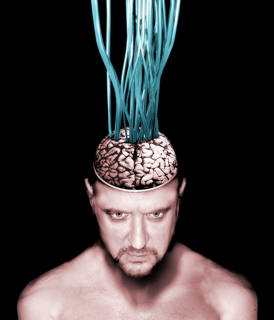 Wired brain