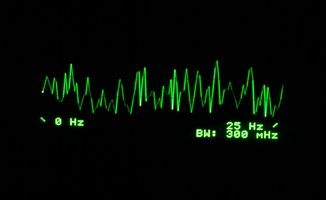 Brain activity 0-25 Hz,supressed 13.25Hz signal